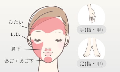Sパーツプラン