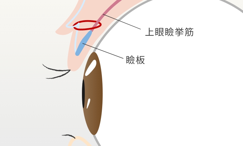 挙筋法